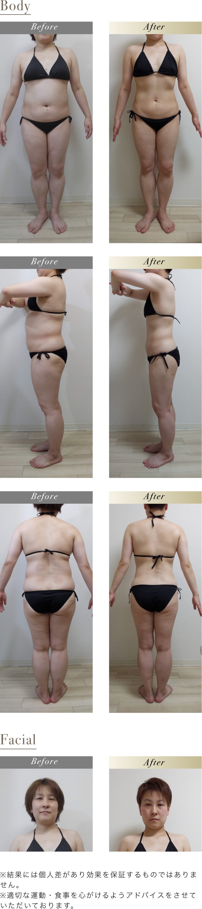 before after