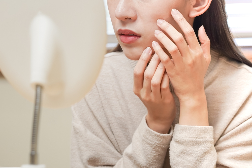 光フェイシャルでニキビが一時的に増える原因と対処法