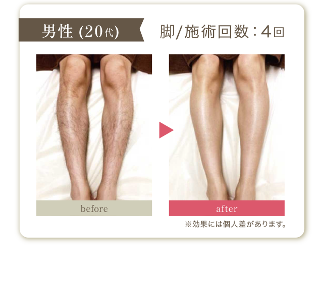 男性20代