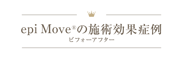 epi moveの施術効果症例
