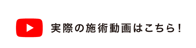 実際の施術動画