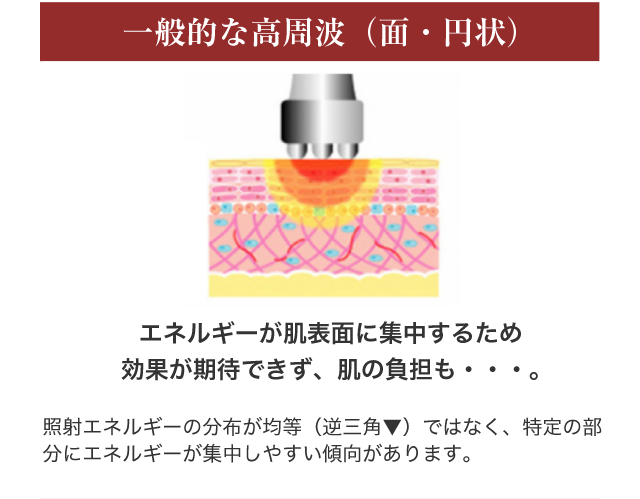 一般的な高周波（面・円状）