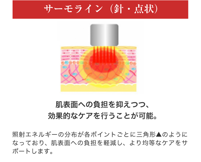 サーモライン（針・点状）