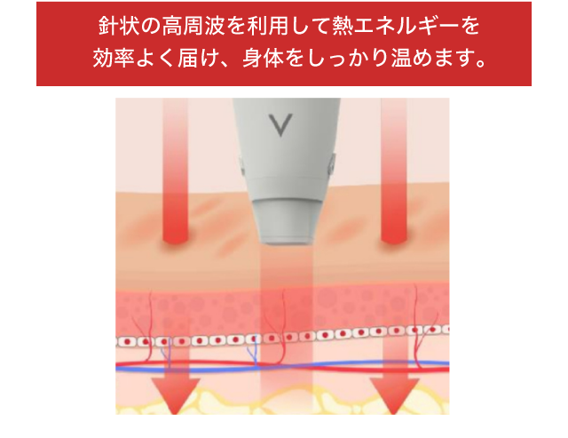 針状の高周波を利用して熱エネルギーを効率よく届け、身体をしっかり温めます。