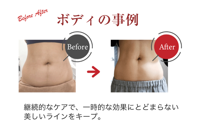 ボディの事例