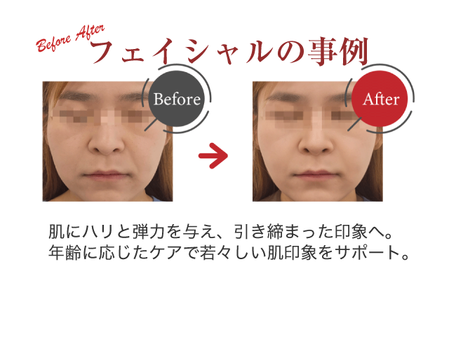 フェイシャルの事例