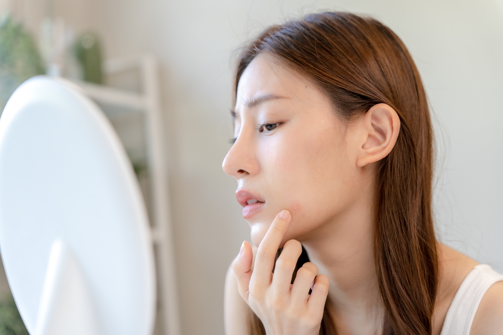 ニキビは毛穴洗浄でケアできる？